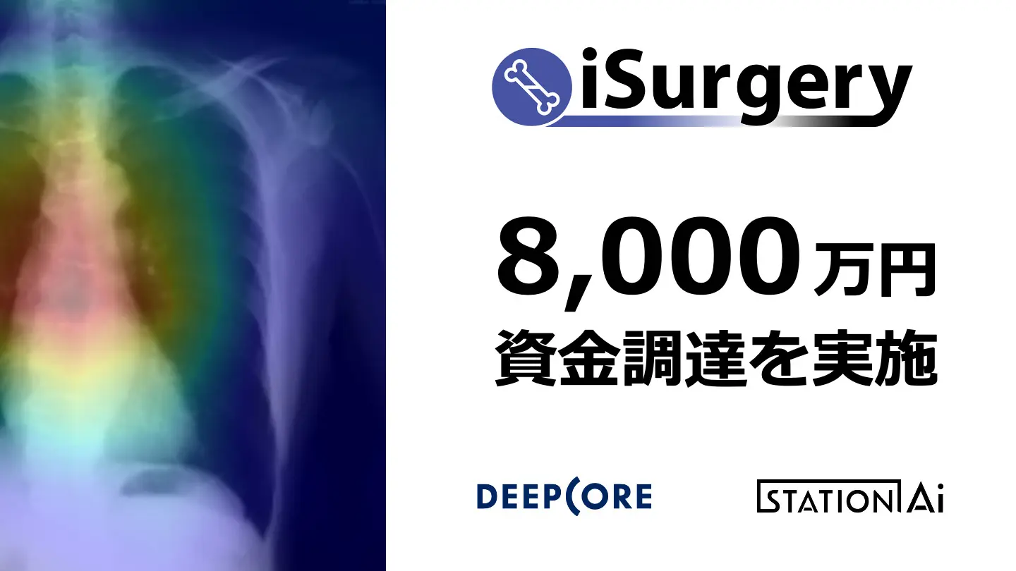 骨粗しょう症検診用AI医療機器を開発するiSurgery、AI特化型