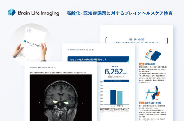 脳MRIのAI解析により海馬領域の体積を測定・可視化できる「Brain Life Imaging」