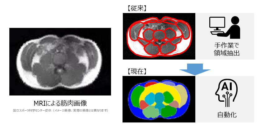 医療画像診断　https://info.hitachi-ics.co.jp/product/medimage_ai/?gad_source=1&gclid=CjwKCAjwxNW2BhAkEiwA24Cm9A0EU1xvYXl9Gbg9-BkJjKcU73Z1cIg6tTuco5hryx03akKbkvUwNxoCW30QAvD_BwE