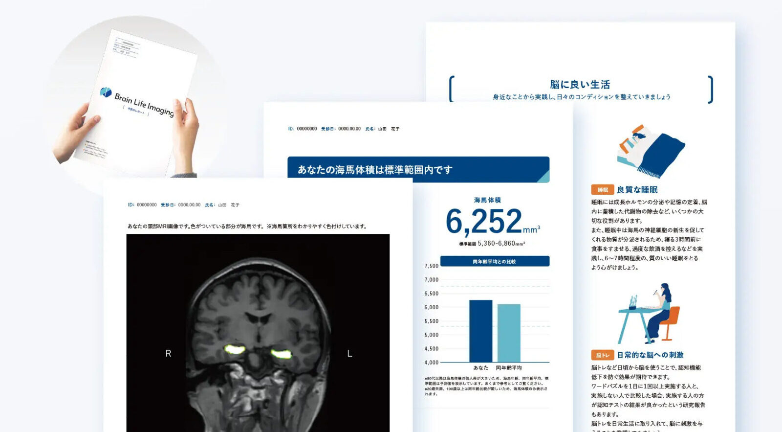 湘南鎌倉総合病院：脳ドック用AI