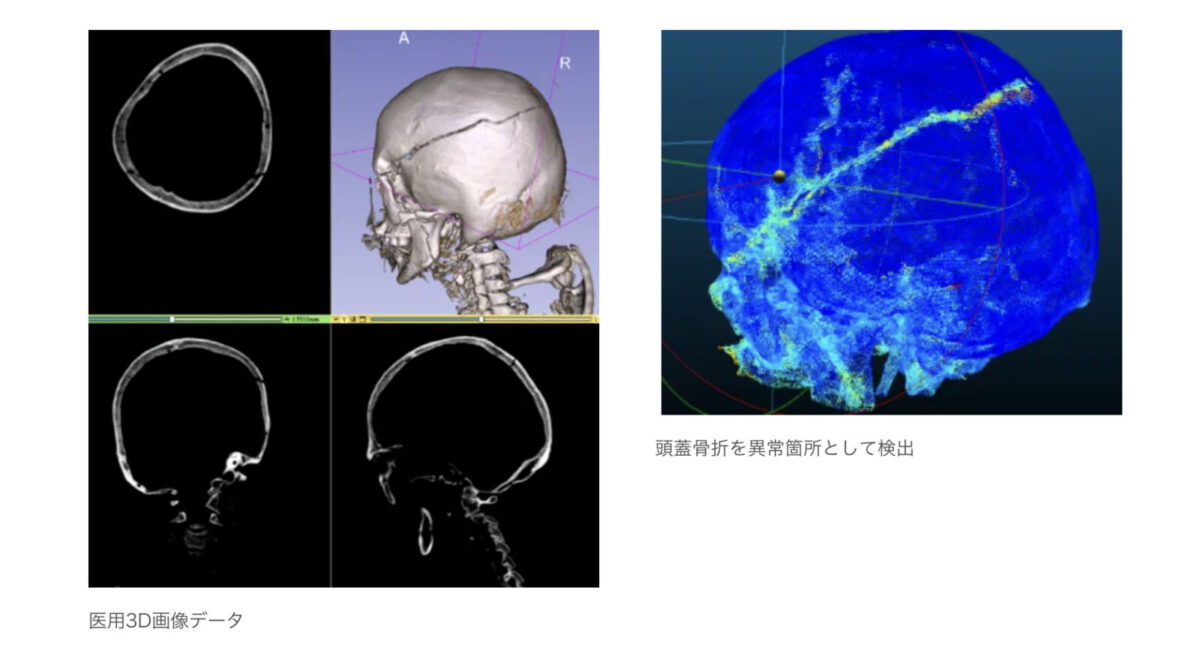 エクセル・クリエイツ、日本初の3D医用画像AI特許出願。鹿児島大学と法医学向け画像診断システムの共同開発