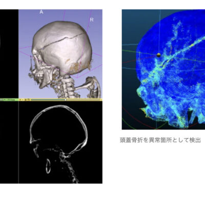 エクセル・クリエイツ、日本初の3D医用画像AI特許出願。鹿児島大学と法医学向け画像診断システムの共同開発